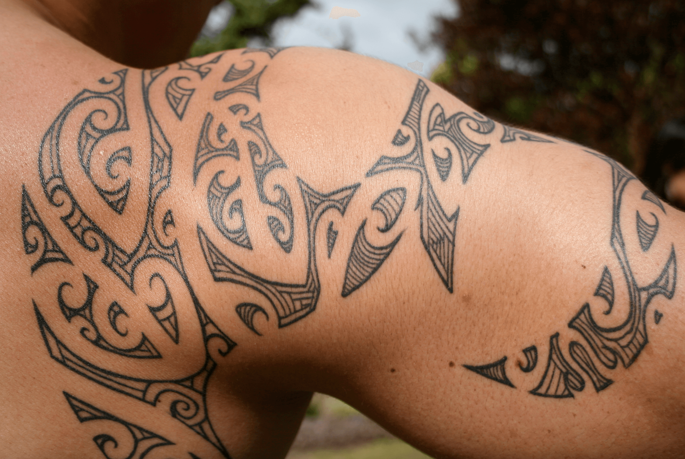 Treatments | Tattoo Removal – Skin Britannia